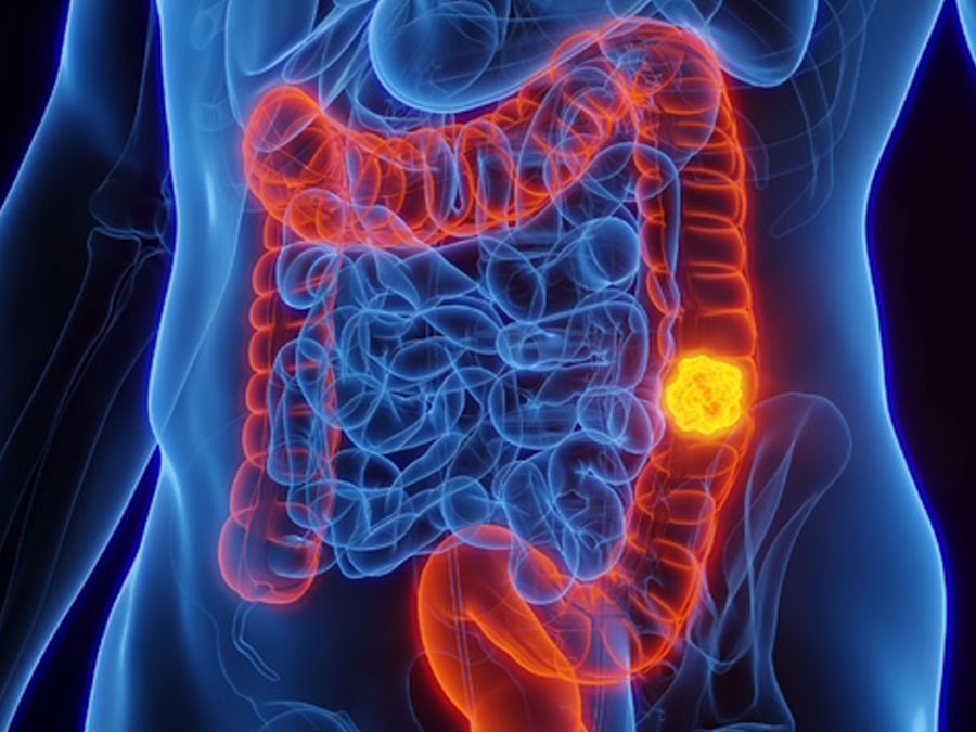 Insights Into The Colon Hydrotherapy Market Growth Projections From 2025 To 2035
